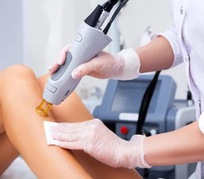 benefitsoflaserhairremoval